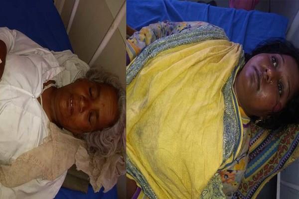 two women were injured in the accident