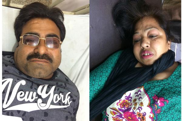 injured husband and wife injured in 2 motorcycle collision