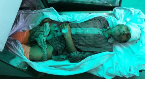 the person died due to falling from the train