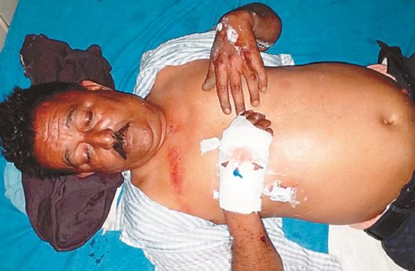 due to a curve  the lineman fell off the pole