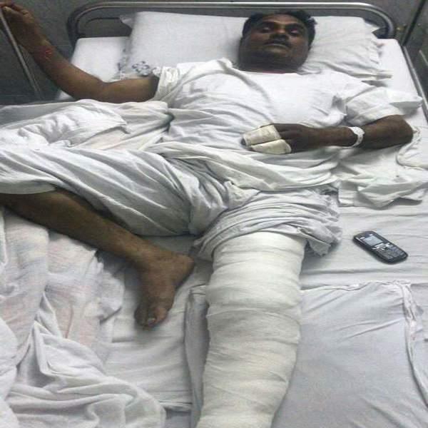 the robbers said  e  he was injured by injuries
