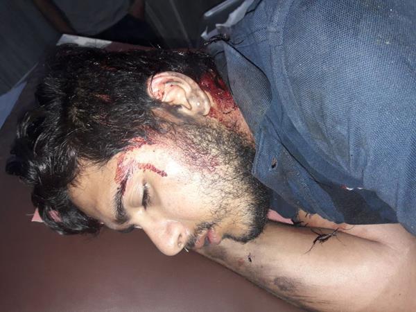 on demanding a bill  the owner of the premises and the servant  s beat up