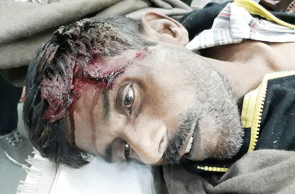 the death of the young due to a deep head injury