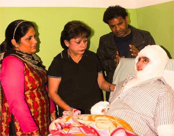 help of acid attack victim