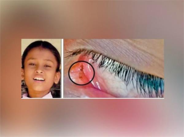 the ants coming from the girl  s eyes