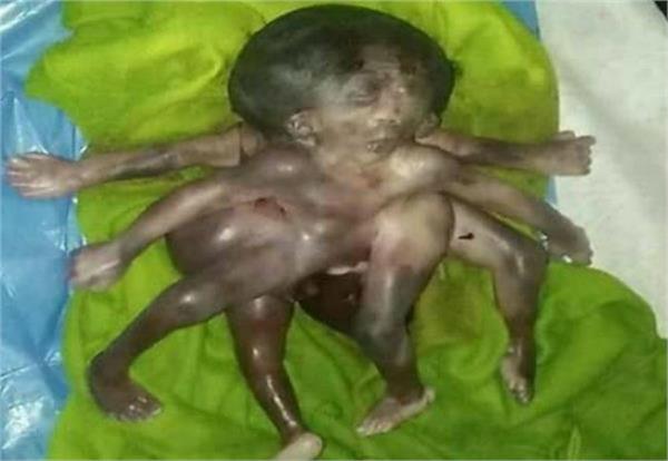 woman  wonderful children  birth