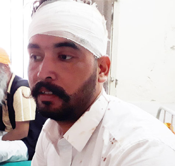 ਵਿਆਹ ਸਮਾਗਮ 'ਚ ਤਕਰਾਰ ਤੋਂ ਬਾਅਦ ਚੱਲੀ ਗੋਲੀ, 1 ਜ਼ਖਮੀ