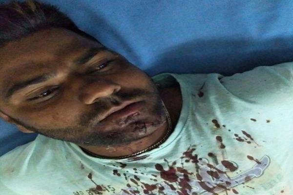 three injured  including brothers and sisters in a dispute clash