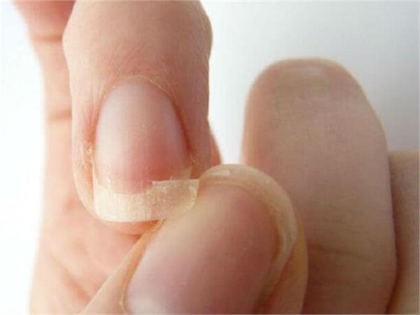 repeat the nails