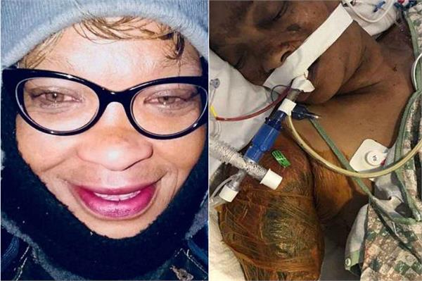 oklahoma woman dies after being mauled by seven of her neighbor  s dogs