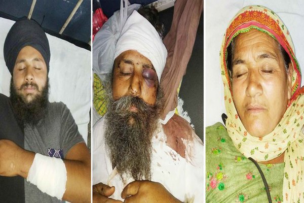 ਰਸਤੇ ਨੂੰ ਲੈ ਕੇ ਝਗਡ਼ਾ, ਪਰਿਵਾਰ ਦੇ 3 ਮੈਂਬਰ ਜ਼ਖਮੀ