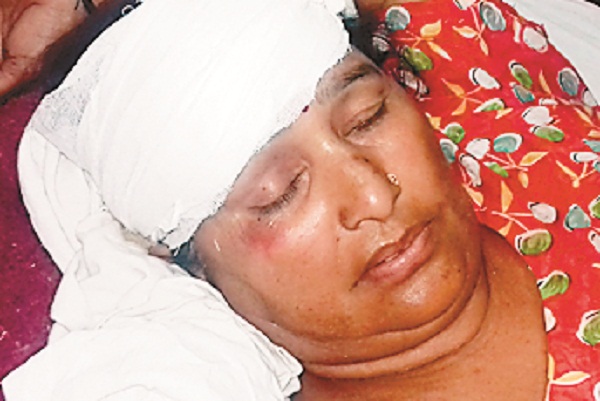 ਸੜਕ ਹਾਦਸੇ ''ਚ ਮਾਂ-ਪੁੱਤ ਜ਼ਖਮੀ