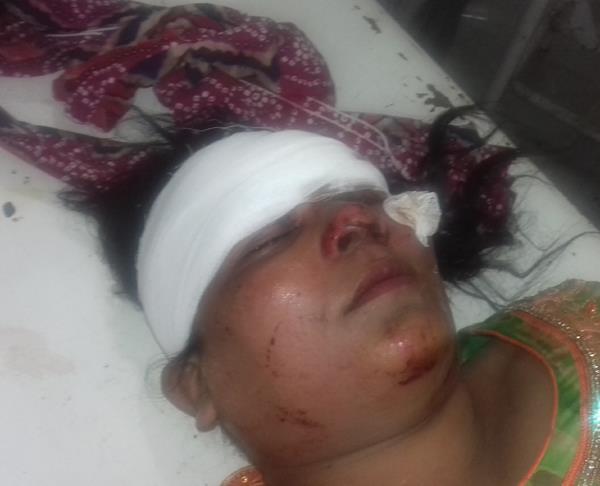 three women were injured in a car