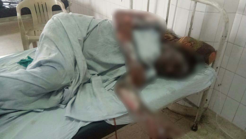 ਜਲੰਧਰ : ਰਾਮਾ ਮੰਡੀ 'ਚ ਪ੍ਰੇਮੀ ਨੇ ਪ੍ਰੇਮਿਕਾ ਨੂੰ ਲਗਾਈ ਅੱਗ