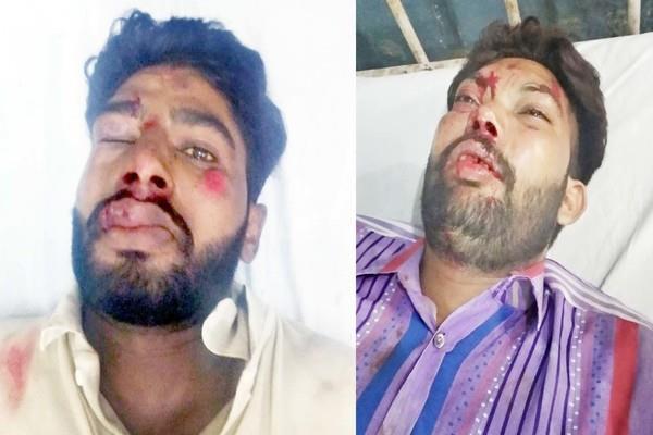 motorcycles collide injured