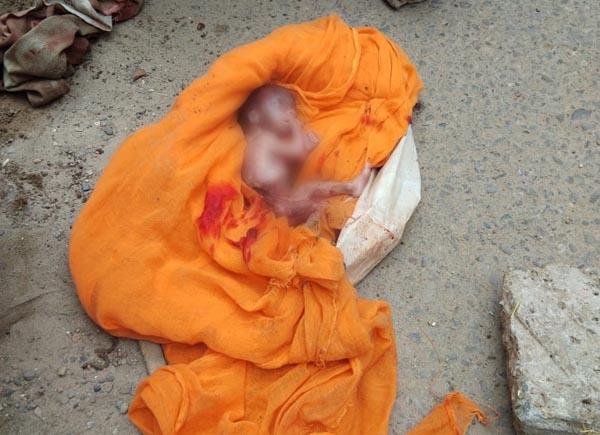 female fetus found in the street outside the house