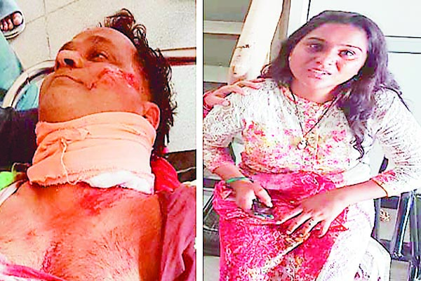 ਕਾਰ ਤੇ ਮੋਟਰਸਾਕੀਲਾਂ ਦੀ ਆਹਮੋ-ਸਾਹਮਣੇ ਟੱਕਰ, 5 ਜ਼ਖਮੀ