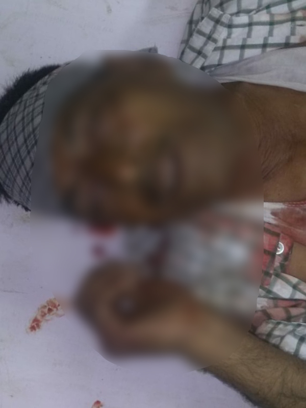 ਸਕੂਟਰ ਸਵਾਰ ਗੰਭੀਰ ਜ਼ਖਮੀ, ਪੀ.ਜੀ.ਆਈ. ਰੈਫਰ