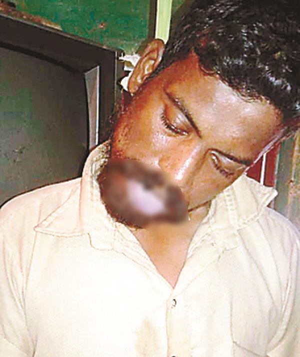 suicide caused by economic hardship