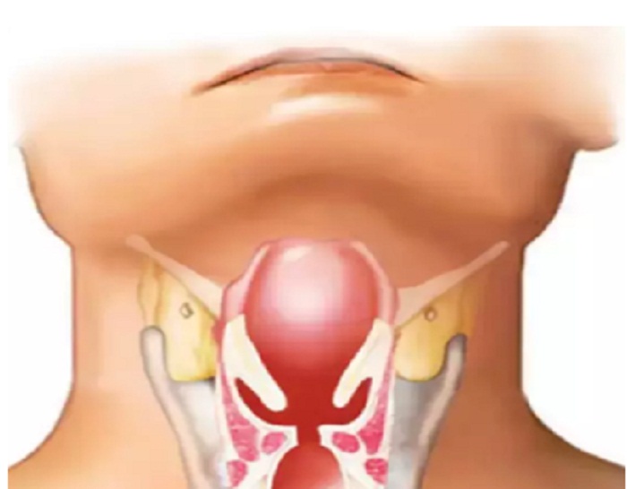 ਡਿਪਥੀਰੀਆ ਦੀ ਬੀਮਾਰੀ ਦੇ ਲੱਛਣ ਅਤੇ ਬਚਾਅ ਦੇ ਤਰੀਕੇ