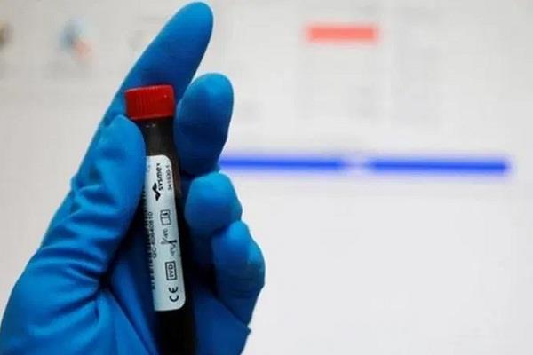 case registered against a person for dope test positive