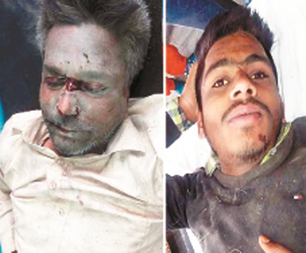 two injured due to a motorcycle slip