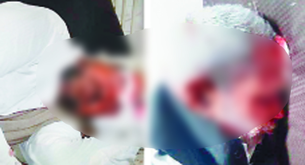 ਸਡ਼ਕ ਹਾਦਸੇ ’ਚ 2 ਵਿਅਕਤੀ ਜ਼ਖਮੀ