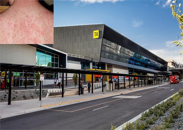 warning diagnosed measles flight