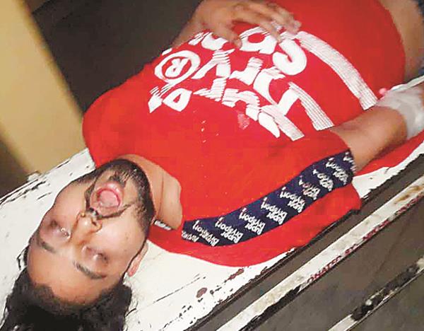 gangster lali cheema injured in cross firing