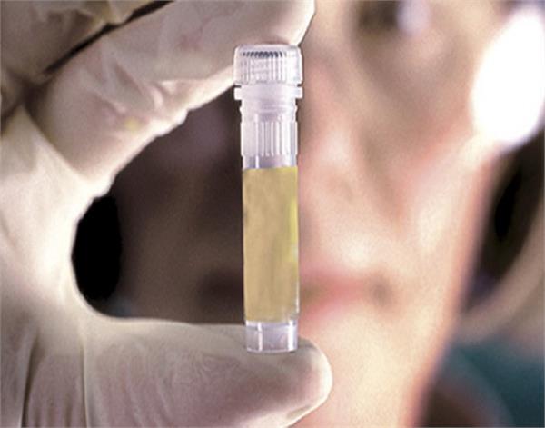 amritsar  dope test  addicts