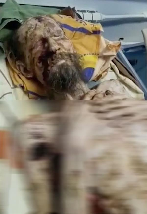 man dragged away by a bear is found alive one month later