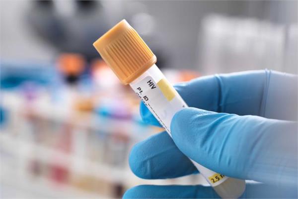 hiv diagnoses australia low