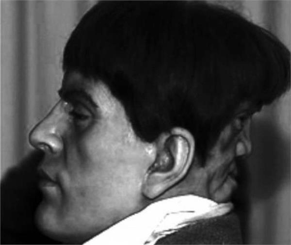 man with 2 faces