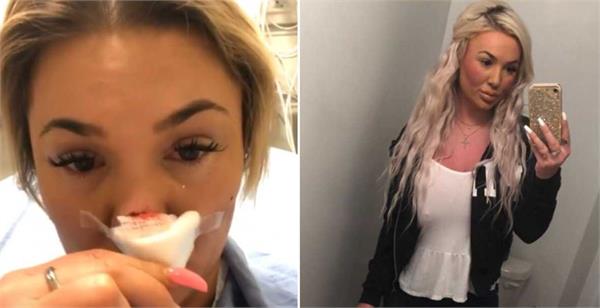 during the fight  the boyfriend cut his girlfriend  s nose