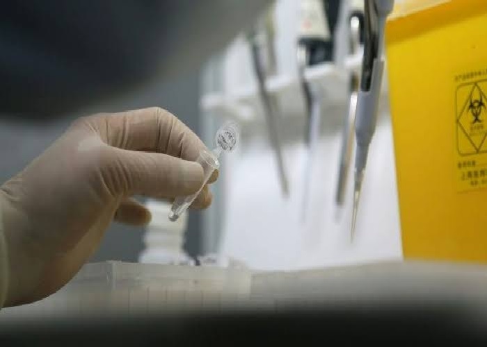 ਚੀਨ ਨੇ ਪਾਕਿਸਤਾਨ ਨੂੰ ਮੁਹੱਈਆ ਕਰਾਈਆਂ ਕੋਰੋਨਾਵਾਇਰਸ ਦੀਆਂ ਜਾਂਚ ਕਿੱਟਾਂ