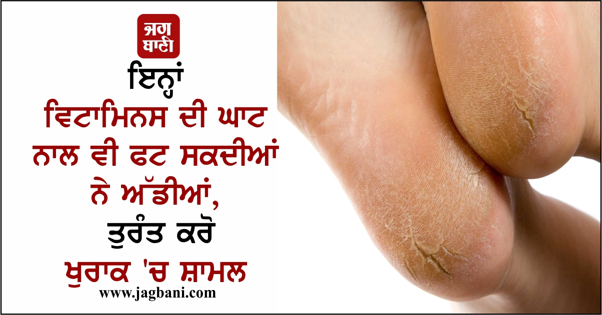 ਇਨ੍ਹਾਂ ਵਿਟਾਮਿਨਸ ਦੀ ਘਾਟ ਨਾਲ ਵੀ ਫਟ ਸਕਦੀਆਂ ਨੇ ਅੱਡੀਆਂ, ਤੁਰੰਤ ਕਰੋ ਖੁਰਾਕ ''ਚ ਸ਼ਾਮਲ