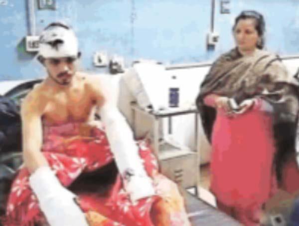 arms broken by assault with sharp weapons