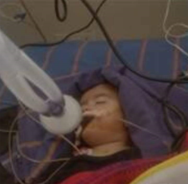 ਮੋਟਰਸਾਈਕਲ ਦੀ ਟੱਕਰ ਨਾਲ ਐਕਟਿਵਾ ਸਵਾਰ ਪਤੀ-ਪਤਨੀ ਅਤੇ ਬੱਚੇ ਜ਼ਖ਼ਮੀ