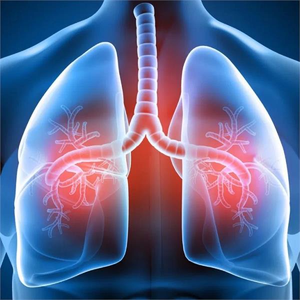 lung diseases have increased due to deteriorating lifestyle