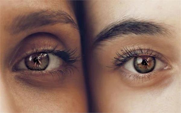 dark circles  potato mask  eyes