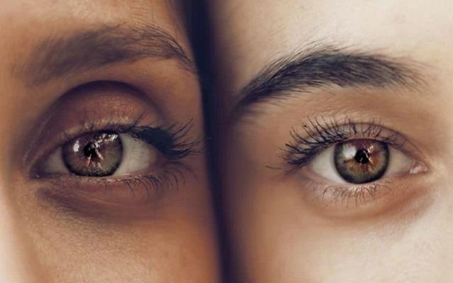 2 ਦਿਨਾਂ ''ਚ ਡਾਰਕ ਸਰਕਲਜ਼ ਗਾਇਬ ਕਰੇਗਾ ਆਲੂ ਦਾ ਮਾਸਕ, ਇੰਝ ਕਰੋ ਅਪਲਾਈ