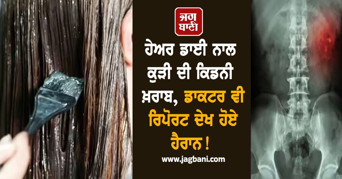 ਹੇਅਰ ਡਾਈ ਨਾਲ ਕੁੜੀ ਦੀ ਕਿਡਨੀ ਖ਼ਰਾਬ, ਡਾਕਟਰ ਵੀ ਰਿਪੋਰਟ ਦੇਖ ਹੋਏ ਹੈਰਾਨ!