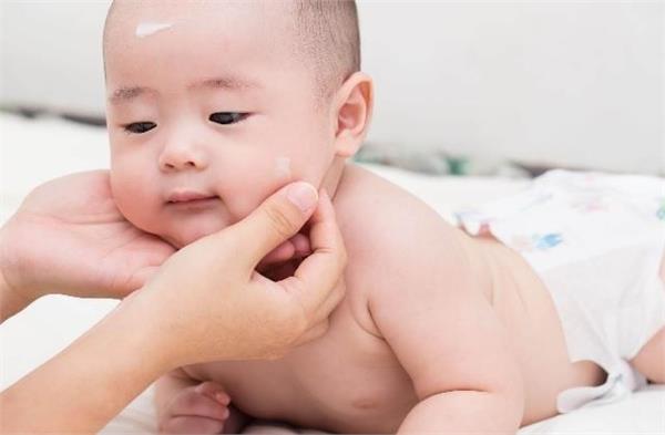 children  skin  rashes  skin care