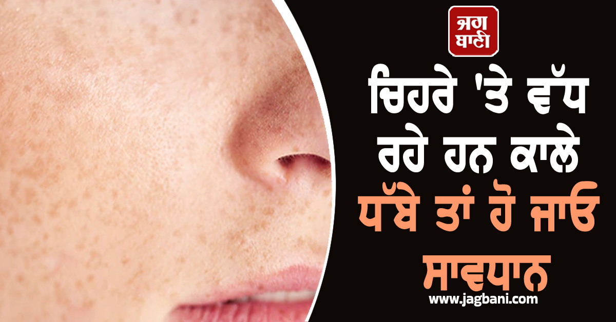 ਚਿਹਰੇ ''ਤੇ ਵੱਧ ਰਹੇ ਹਨ ਕਾਲੇ ਧੱਬੇ ਤਾਂ ਹੋ ਜਾਓ ਸਾਵਧਾਨ, ਇਸ ਬੀਮਾਰੀ ਦੇ ਹੋ ਸਕਦੇ ਹੋ ਸ਼ਿਕਾਰ