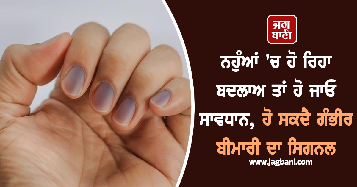 ਨਹੁੰਆਂ ''ਚ ਹੋ ਰਿਹਾ ਬਦਲਾਅ ਤਾਂ ਹੋ ਜਾਓ ਸਾਵਧਾਨ, ਹੋ ਸਕਦੈ ਗੰਭੀਰ ਬੀਮਾਰੀ ਦਾ ਸਿਗਨਲ