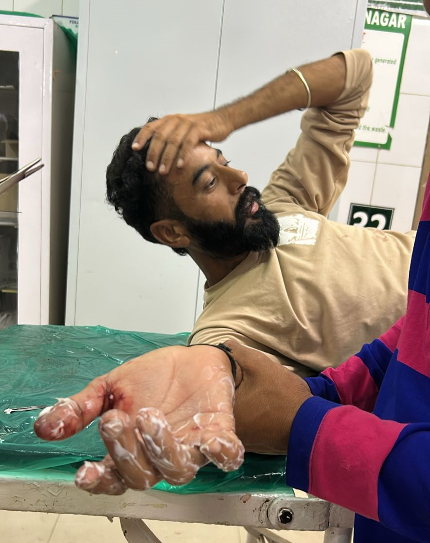 ਰੂਪਨਗਰ ਵਿਖੇ ਪਟਾਕਿਆਂ ਕਾਰਨ ਅੱਧੀ ਦਰਜਨ ਤੋਂ ਵੱਧ ਵਿਅਕਤੀ ਹੋਏ ਜ਼ਖ਼ਮੀ