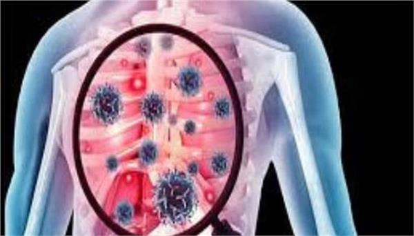 tb cases increasing in this state