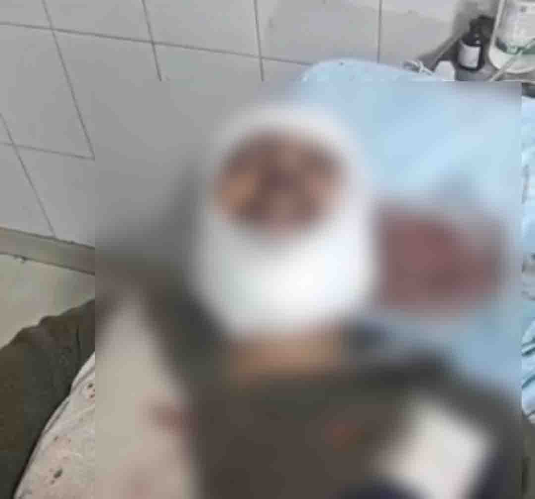 ਲੁਧਿਆਣਾ ''ਚ ਫੈਕਟਰੀ ਅੰਦਰ ਆ ਵੜੇ ਲੁਟੇਰੇ! ਗਾਰਡ ਦੀਆਂ ਤੋੜ''ਤੀਆਂ ਲੱਤਾਂ, ਸਿਰ ''ਚ ਲੱਗੇ 25 ਟਾਂਕੇ