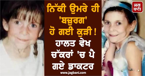 viral news old age came as soon as he was born 