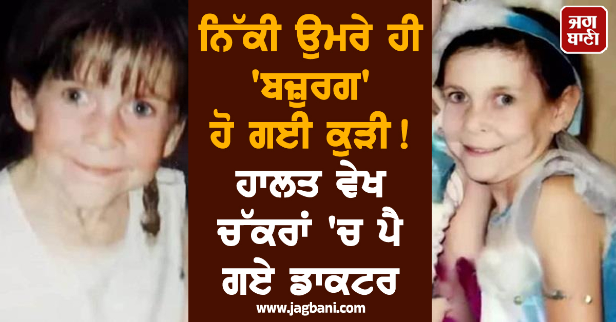 ਨਿੱਕੀ ਉਮਰੇ ਹੀ 'ਬਜ਼ੁਰਗ' ਹੋ ਗਈ ਕੁੜੀ! ਹਾਲਤ ਵੇਖ ਚੱਕਰਾਂ 'ਚ ਪੈ ਗਏ ਡਾਕਟਰ